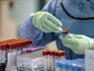 Коронавірус на Волині: за минулу добу виявили 448 нових інфікованих