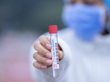 Ранок 15 червня: в Україні – 656 нових випадків коронавірусу за добу, з них на Волині – 40