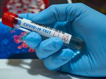 На Волині за добу зафіксували 462 випадки коронавірусу, одна людина померла