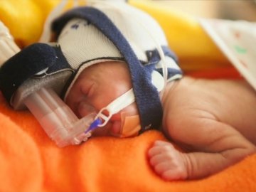 80 днів боротьби: фотоісторія малюка, що народився з вагою у півкілограма