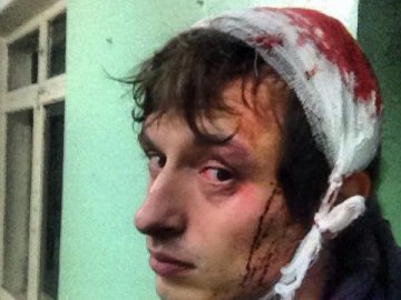 Від кийків «Беркуту» та газу 1 грудня постраждали понад 40 журналістів