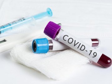 В Україні зафіксували новий антирекорд  – 753 випадки COVID-19 за добу