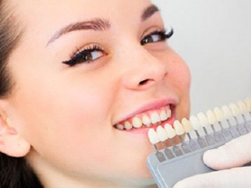«За» та «проти» відбілювання зубів: експерт з Волині розповіла про нюанси процедури