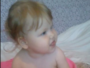 Померла 2-річна дівчинка з Луцька, яку паралізувало через пневмонію