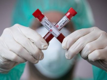 Скільки нових заражених коронавірусом виявили в Україні за минулу добу 