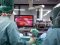 Волинські хірурги уперше провели операцію в 3D-вимірі: пацієнтці видалили пухлину