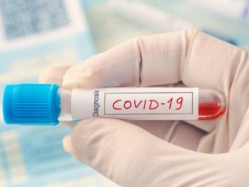 Нові спалахи коронавірусу на Волині зафіксували у коледжі та на підприємстві 