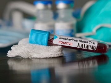 16 нових випадків і дві смерті: ситуація із коронавірусом на Волині за останню добу