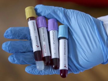 В Україні – 683 нові випадки коронавірусу, з них на Волині – 47