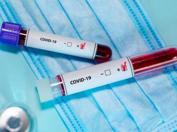 В Україні за добу на коронавірус захворіло понад 100 лікарів