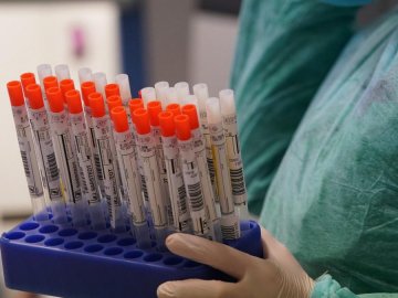 Одна смерть і 47 нових випадків: ситуація з коронавірусом на Волині за останню добу