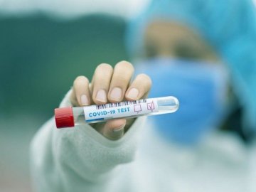 Ранок 27 липня: в Україні –  807 нових випадків коронавірусу, на Волині – 56