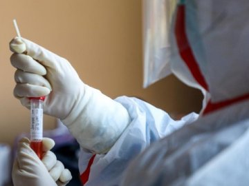 В Україні – 84 підтверджених випадки коронавірусу
