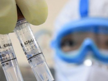 В Україні – 463 нових випадки коронавірусу за добу