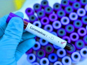 Офіційно підтвердили другий випадок коронавірусу на Волині