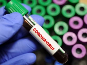 У жінки із Шацького району виявили коронавірус
