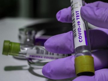 В Україні – понад 15 000 нових випадків коронавірусу