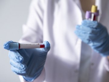 65 хворих і дві смерті: де на Волині виявили нові випадки коронавірусу станом на 13 вересня
