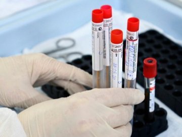 Дві смерті та 140 нових хворих: ситуація з коронавірусом на Волині за останню добу