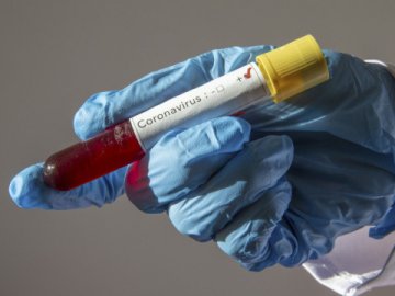 Головний держінспектор Поліської митниці захворіла на коронавірус