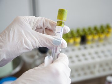 Ранок 8 липня: в Україні – 807 нових випадків коронавірусу, з них на Волині – 37