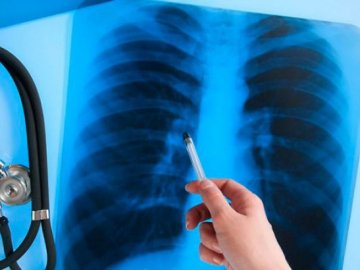 Не тільки Covid-19: за жовтень в Україні виявили понад тисячу випадків туберкульозу