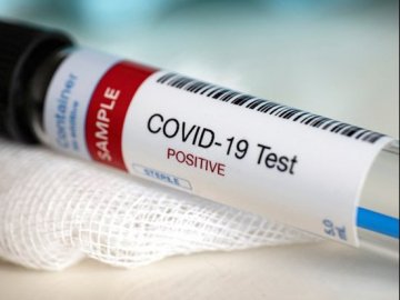 Третій випадок інфікування коронавірусом підтвердили у районі на Волині 
