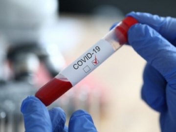 Повідомили, скільки нових заражених коронавірусом виявили в Україні за минулу добу