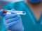 Ранок 14 жовтня: в Україні – 5 590 нових випадків коронавірусу, на Волині – антирекорд