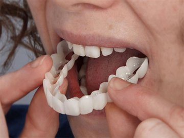 Як правильно доглядати за знімними зубними протезами?*