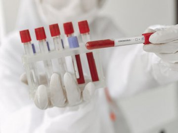 В Україні – новий рекорд за кількістю нових випадків коронавірусу за добу
