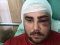 Двоє нетверезих чоловіків побили активіста «АвтоЄвроСили». ФОТО