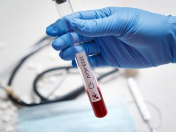 Дві смерті у Луцьку і 45 нових випадків: ситуація з коронавірусом на Волині станом на 10 серпня