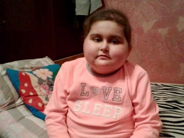 Турецька клініка погодилась оперувати Настю Абрамчук: потрібні кошти