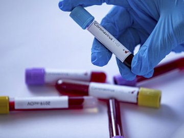 За добу в Україні зареєстрували більше 2000 нових випадків коронавірусу 