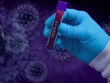 Повідомили, скільки нових заражених коронавірусом виявили в Україні за добу