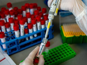 11 працівників РДА на Волині захворіли на коронавірус