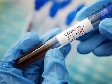 357 хворих та 5 смертей: де на Волині виявили нові випадки коронавірусу