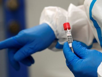 Три смерті і 61 новий випадок: ситуація з коронавірусом на Волині за останню добу