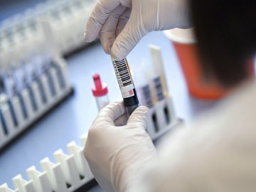 У гематологічному відділенні волинської обласної лікарні підтвердили 15 випадків коронавірусу