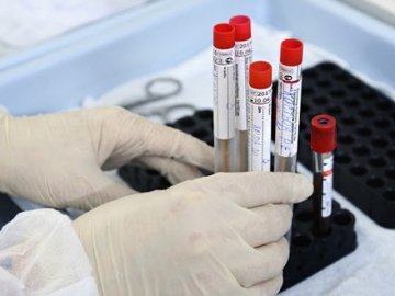 Найбільше за весь час пендемії: в Україні –  2 723 нових випадки коронавірусу за добу, на Волині – 61