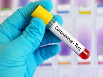 В Україні швидкі тести на коронавірус почнуть продавати в аптеках
