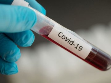 Де і за скільки у Луцьку можна зробити ІФА-тест на коронавірус