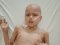 У Луцьку шукають донорів тромбоцитів для 6-річного хлопчика