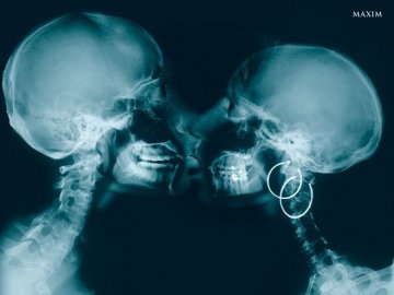 10 незвичайних рентгенівських знімків. ФОТО