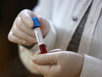 В Україні – найбільший за 4 місяці добовий показник щодо коронавірусу