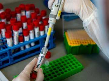 Шість смертей і майже 400 нових випадків: ситуація з коронавірусом на Волині за останню добу