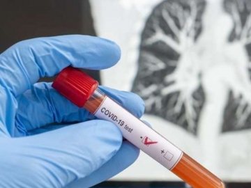 Ковідна статистика: повідомили, скільки заражених коронавірусом виявили в Україні за добу