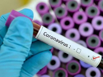У Луцьку за добу – 7 нових випадків коронавірусу