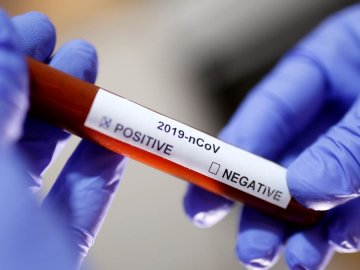 В Україні підтвердили 1251 випадок захворювання на коронавірус